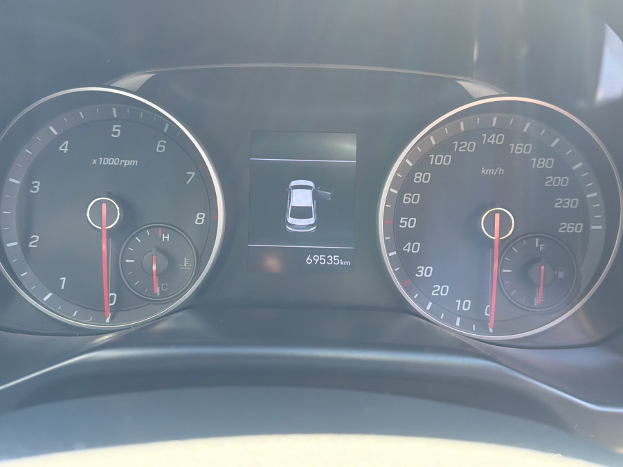 2020 Hyundai Elantra AD.2 Sport Sedan Image 19