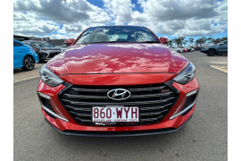 2016 MY17 Hyundai Elantra AD SR Sedan